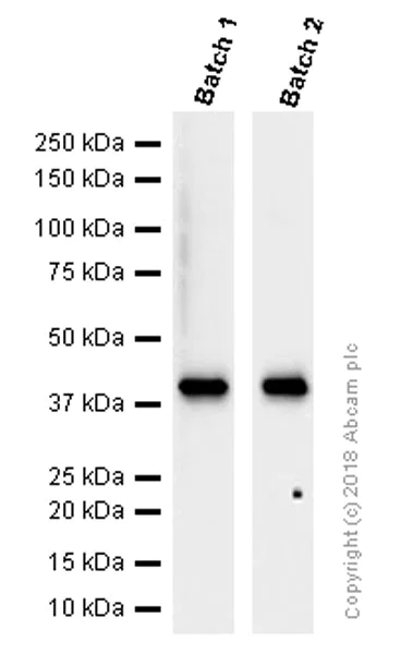 Western blot - Anti-Cytokeratin 19 antibody [EP1580Y] - Cytoskeleton Marker (AB52625)