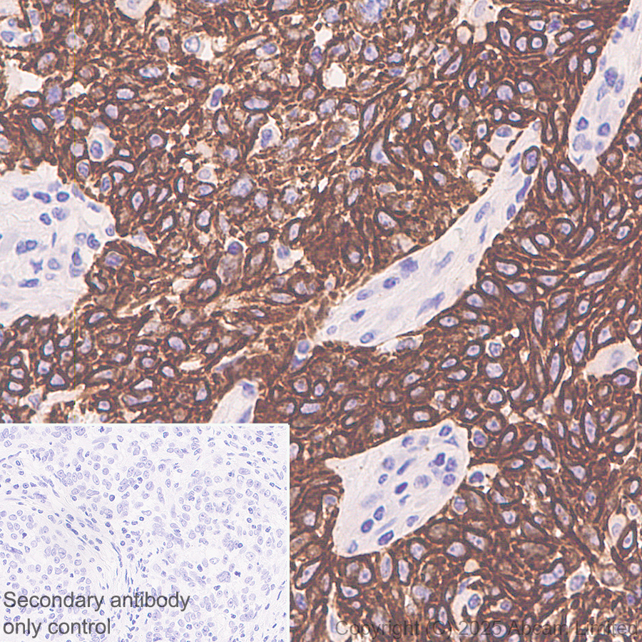 Immunohistochemistry (Formalin/PFA-fixed paraffin-embedded sections) - Anti-Cytokeratin 19 antibody [EP1580Y] - Mouse IgG2a (Chimeric) (ab323562), expandable thumbnail