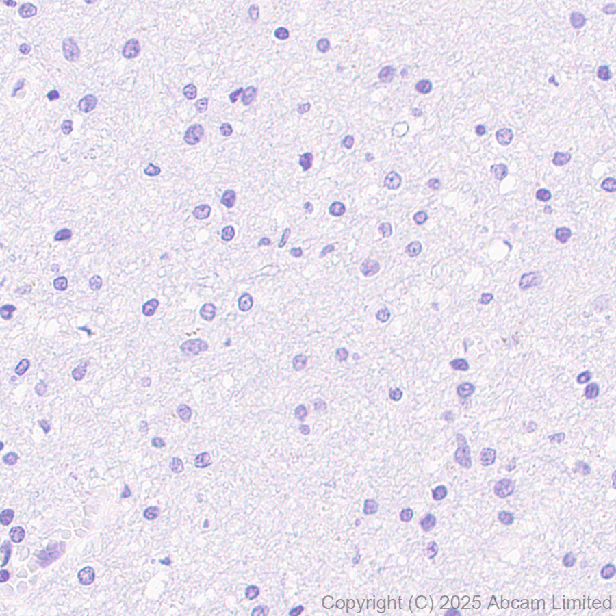 Immunohistochemistry (Formalin/PFA-fixed paraffin-embedded sections) - Anti-Cytokeratin 19 antibody [EP1580Y] - Mouse IgG2a (Chimeric) (AB323562), expandable thumbnail