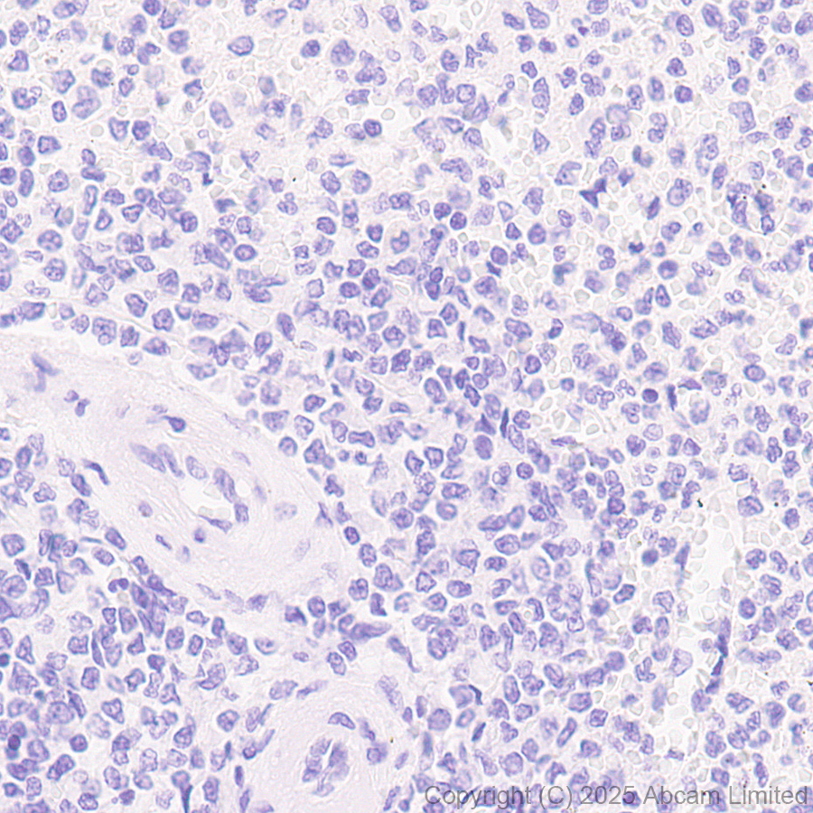 Immunohistochemistry (Formalin/PFA-fixed paraffin-embedded sections) - Anti-Cytokeratin 19 antibody [EP1580Y] - Mouse IgG2a (Chimeric) (AB323562), expandable thumbnail