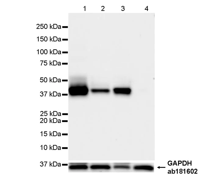 Western blot - Anti-Cytokeratin 19 antibody [EP1580Y] - Mouse IgG2a (Chimeric) (AB323562)