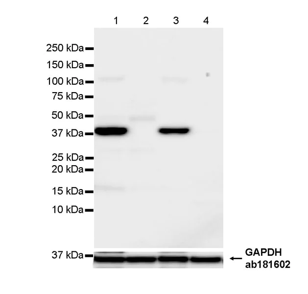 Western blot - Anti-Cytokeratin 19 antibody [EP1580Y] - Mouse IgG2a (Chimeric) (AB323562)