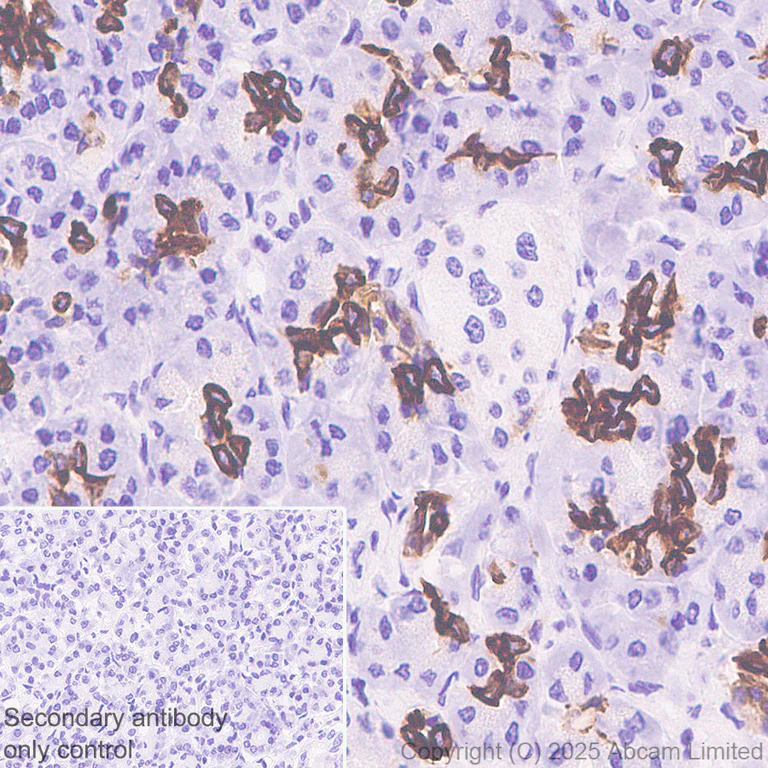 Immunohistochemistry (Formalin/PFA-fixed paraffin-embedded sections) - Anti-Cytokeratin 19 antibody [EP1580Y] - Mouse IgG2a (Chimeric) - BSA and Azide free (AB324850)