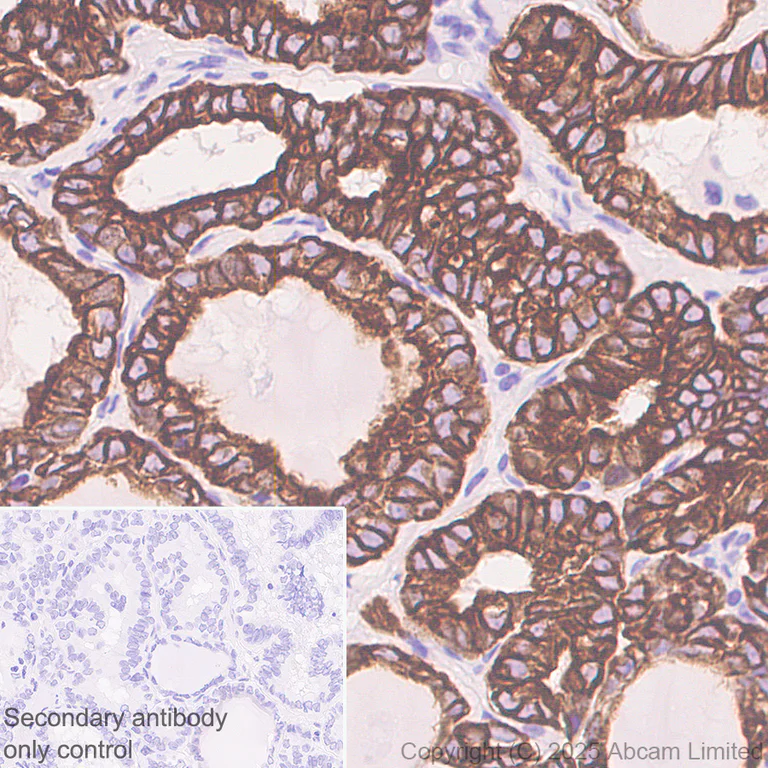 Immunohistochemistry (Formalin/PFA-fixed paraffin-embedded sections) - Anti-Cytokeratin 19 antibody [EP1580Y] - Mouse IgG2a (Chimeric) - BSA and Azide free (AB324850)