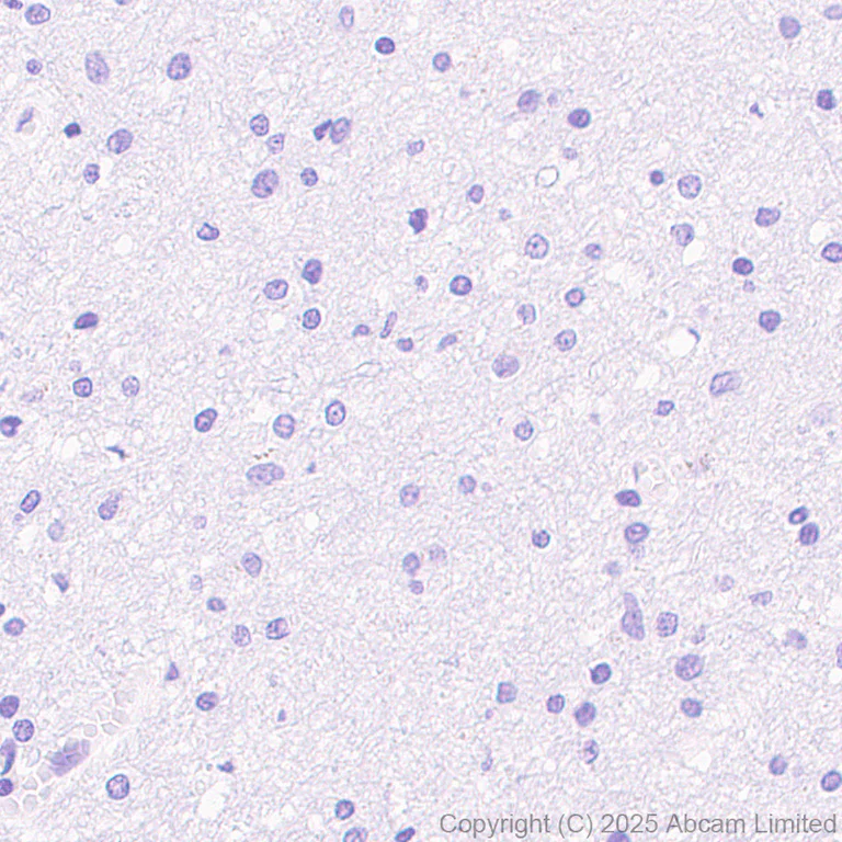 Immunohistochemistry (Formalin/PFA-fixed paraffin-embedded sections) - Anti-Cytokeratin 19 antibody [EP1580Y] - Mouse IgG2a (Chimeric) - BSA and Azide free (AB324850)