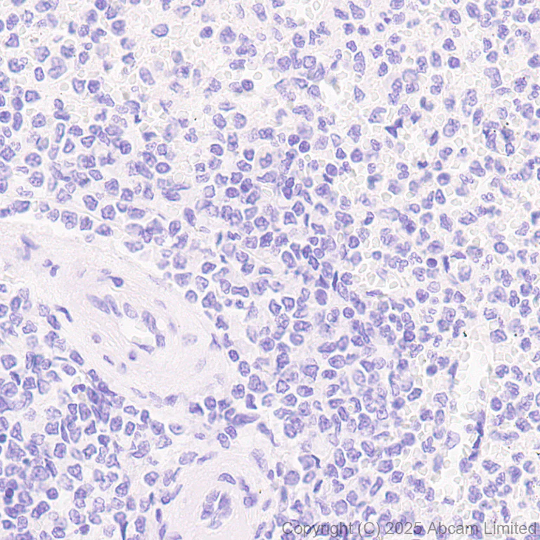 Immunohistochemistry (Formalin/PFA-fixed paraffin-embedded sections) - Anti-Cytokeratin 19 antibody [EP1580Y] - Mouse IgG2a (Chimeric) - BSA and Azide free (AB324850)