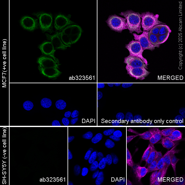Immunocytochemistry/ Immunofluorescence - Anti-Cytokeratin 19 antibody [EP1580Y] - Rat IgG2a (Chimeric) (AB323561), expandable thumbnail