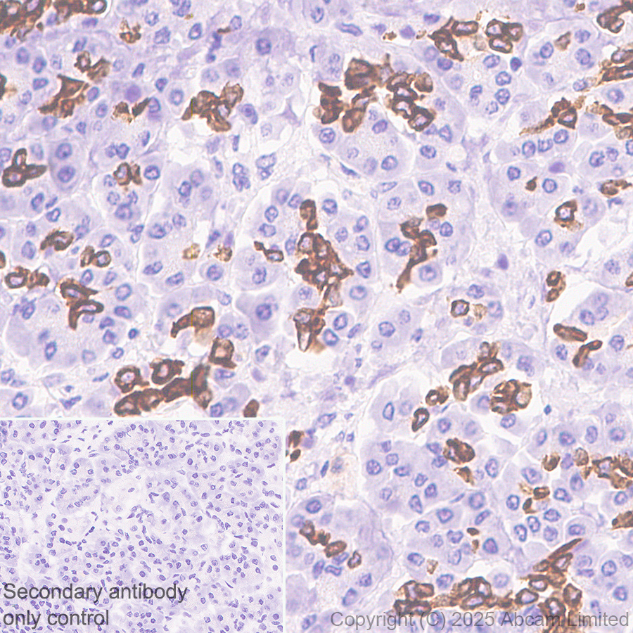 Immunohistochemistry (Formalin/PFA-fixed paraffin-embedded sections) - Anti-Cytokeratin 19 antibody [EP1580Y] - Rat IgG2a (Chimeric) (ab323561), expandable thumbnail