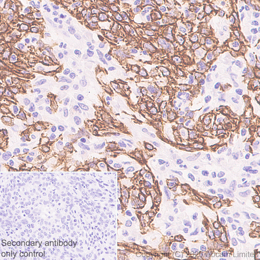 Immunohistochemistry (Formalin/PFA-fixed paraffin-embedded sections) - Anti-Cytokeratin 19 antibody [EP1580Y] - Rat IgG2a (Chimeric) (ab323561), expandable thumbnail