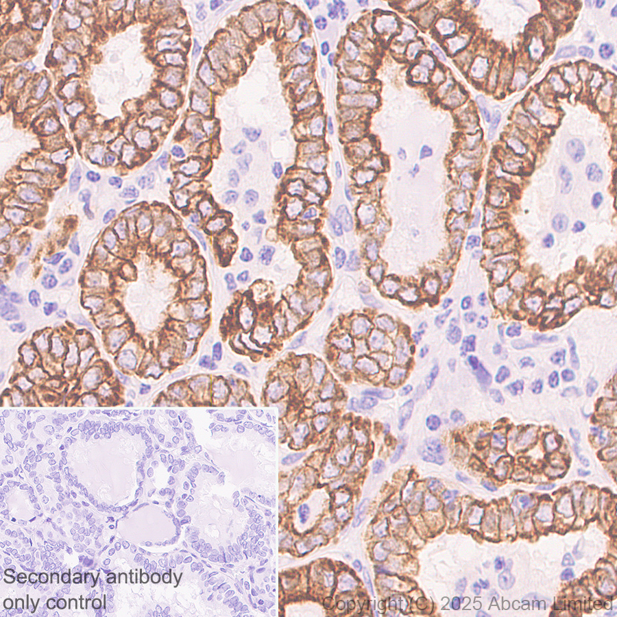 Immunohistochemistry (Formalin/PFA-fixed paraffin-embedded sections) - Anti-Cytokeratin 19 antibody [EP1580Y] - Rat IgG2a (Chimeric) (AB323561), expandable thumbnail