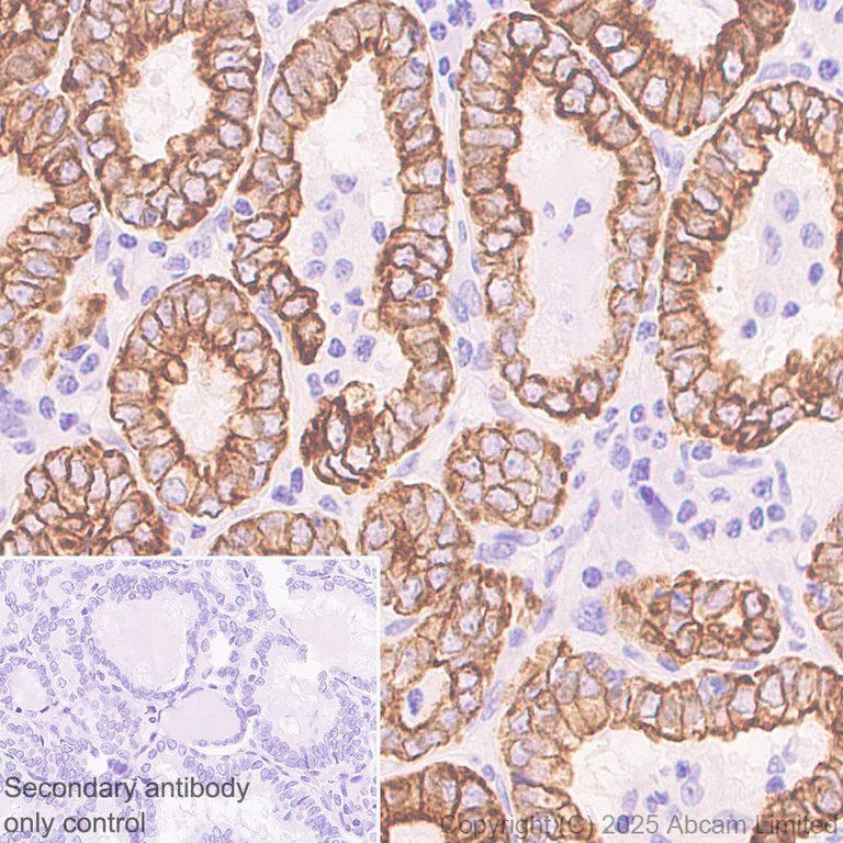 Immunohistochemistry (Formalin/PFA-fixed paraffin-embedded sections) - Anti-Cytokeratin 19 antibody [EP1580Y] - Rat IgG2a (Chimeric) (AB323561)