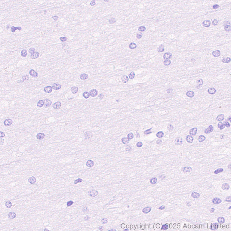 Immunohistochemistry (Formalin/PFA-fixed paraffin-embedded sections) - Anti-Cytokeratin 19 antibody [EP1580Y] - Rat IgG2a (Chimeric) (AB323561)