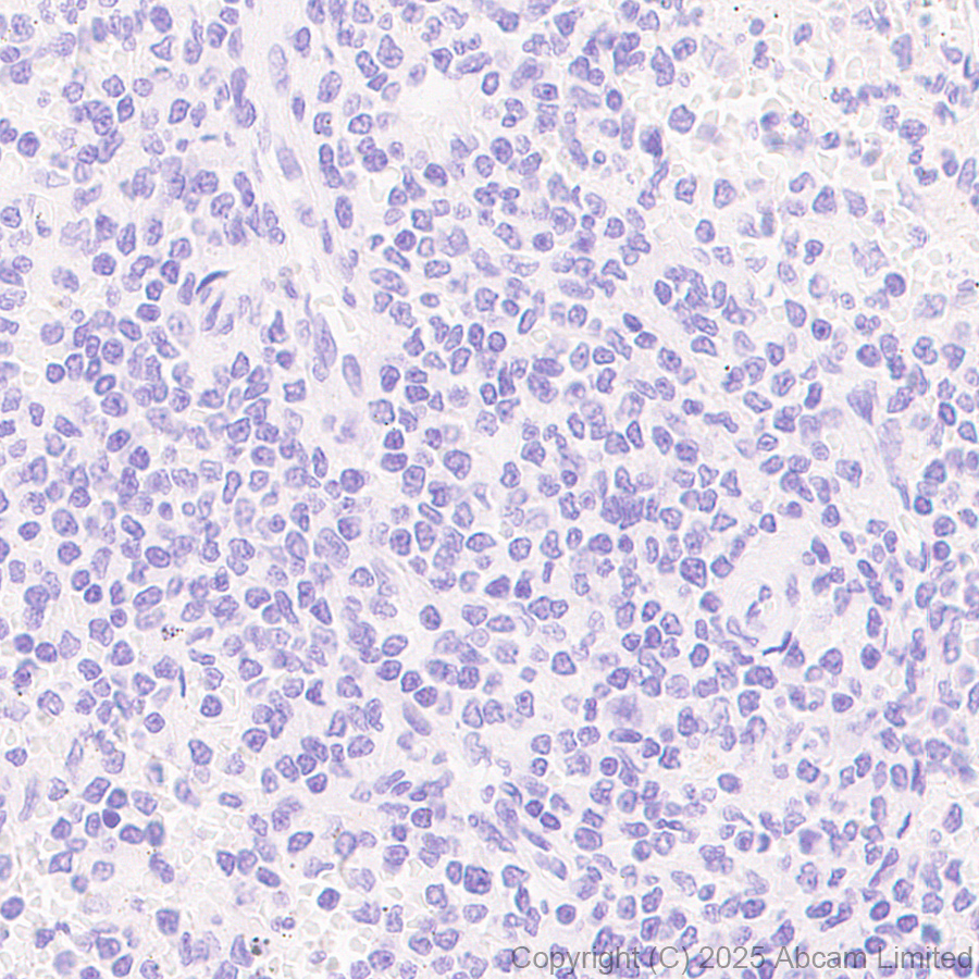 Immunohistochemistry (Formalin/PFA-fixed paraffin-embedded sections) - Anti-Cytokeratin 19 antibody [EP1580Y] - Rat IgG2a (Chimeric) (AB323561), expandable thumbnail