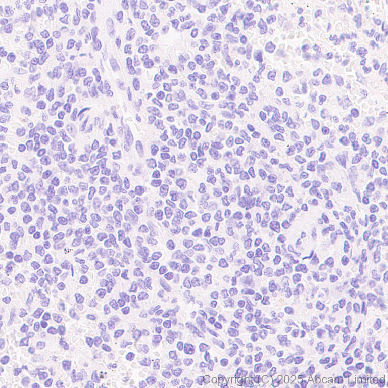 Immunohistochemistry (Formalin/PFA-fixed paraffin-embedded sections) - Anti-Cytokeratin 19 antibody [EP1580Y] - Rat IgG2a (Chimeric) (AB323561)