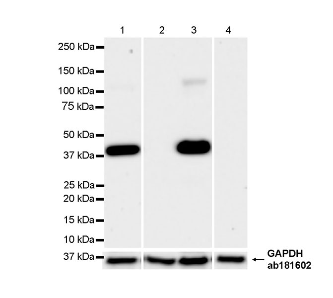 Western blot - Anti-Cytokeratin 19 antibody [EP1580Y] - Rat IgG2a (Chimeric) (ab323561), expandable thumbnail