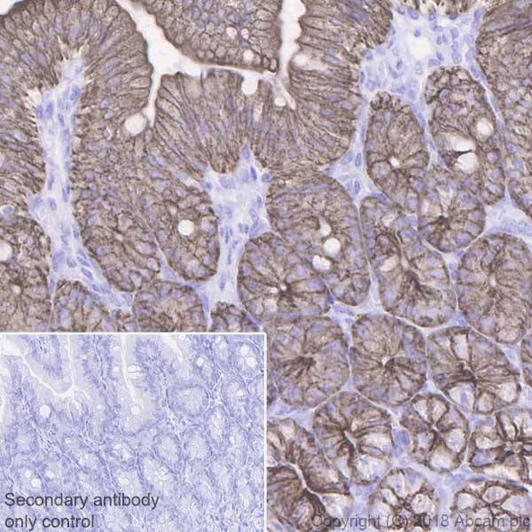 Anti-Cytokeratin 19 antibody [EPNCIR127B]