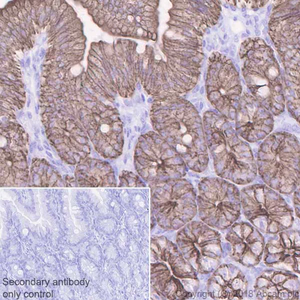 Immunohistochemistry (Formalin/PFA-fixed paraffin-embedded sections) - Anti-Cytokeratin 19 antibody [EPNCIR127B] - BSA and Azide free (AB233174)