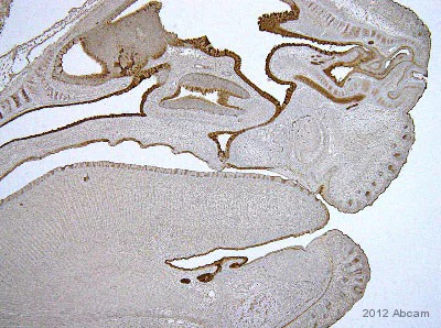 Immunohistochemistry (Formalin/PFA-fixed paraffin-embedded sections) - Anti-Cytokeratin 19 antibody [EPNCIR127B] - BSA and Azide free (AB233174)