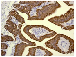 Immunohistochemistry (Formalin/PFA-fixed paraffin-embedded sections) - Anti-Cytokeratin 19 antibody [EPNCIR127B] - BSA and Azide free (AB233174)