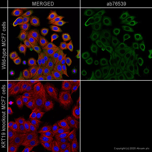 Immunocytochemistry - Anti-Cytokeratin 19 antibody [EPR1579Y] (AB76539)