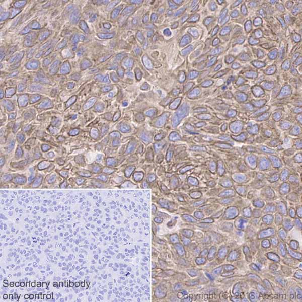 Immunohistochemistry (Formalin/PFA-fixed paraffin-embedded sections) - Anti-Cytokeratin 19 antibody [EPR1579Y] - BSA and Azide free (ab232566), expandable thumbnail