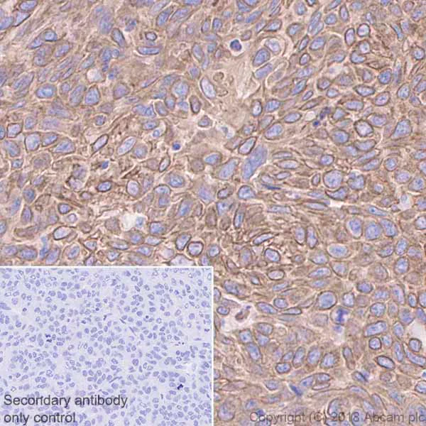 Immunohistochemistry (Formalin/PFA-fixed paraffin-embedded sections) - Anti-Cytokeratin 19 antibody [EPR1579Y] - BSA and Azide free (AB232566)