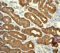 Immunohistochemistry (Formalin/PFA-fixed paraffin-embedded sections) - Anti-Cytokeratin 19 antibody [EPR1579Y] - BSA and Azide free (AB232566), expandable thumbnail