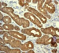 Immunohistochemistry (Formalin/PFA-fixed paraffin-embedded sections) - Anti-Cytokeratin 19 antibody [EPR1579Y] - BSA and Azide free (AB232566)