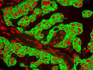 Immunohistochemistry (Formalin/PFA-fixed paraffin-embedded sections) - Anti-Cytokeratin 19 antibody [EPR1579Y] - BSA and Azide free (AB232566)