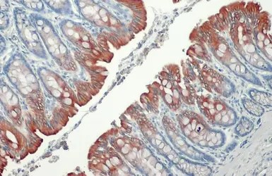 Immunohistochemistry (Formalin/PFA-fixed paraffin-embedded sections) - Anti-Cytokeratin 19 antibody [HL1165] - BSA and Azide free (AB313831), expandable thumbnail