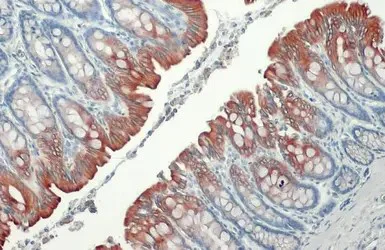 Immunohistochemistry (Formalin/PFA-fixed paraffin-embedded sections) - Anti-Cytokeratin 19 antibody [HL1165] - BSA and Azide free (AB313831)