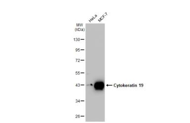 Western blot - Anti-Cytokeratin 19 antibody [HL1165] - BSA and Azide free (AB313831), expandable thumbnail
