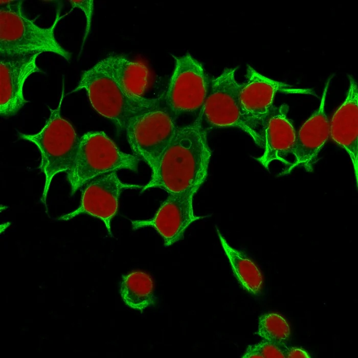 Immunocytochemistry - Anti-Cytokeratin 19 antibody [KRT19/799] - BSA and Azide free (AB212571)
