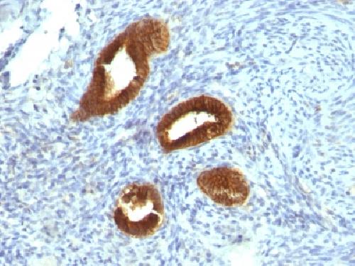 Immunohistochemistry (Formalin/PFA-fixed paraffin-embedded sections) - Anti-Cytokeratin 19 antibody [KRT19/799] - BSA and Azide free (AB212571), expandable thumbnail