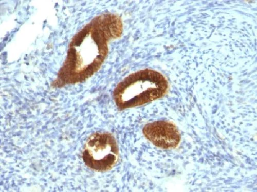 Immunohistochemistry (Formalin/PFA-fixed paraffin-embedded sections) - Anti-Cytokeratin 19 antibody [KRT19/799] - BSA and Azide free (AB212571)