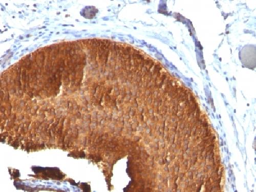 Immunohistochemistry (Formalin/PFA-fixed paraffin-embedded sections) - Anti-Cytokeratin 19 antibody [KRT19/799] - BSA and Azide free (AB212571), expandable thumbnail