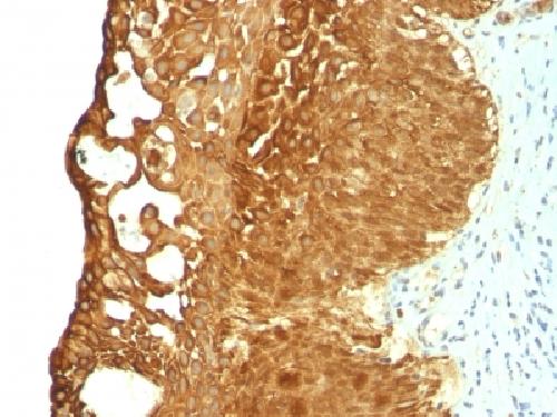 Immunohistochemistry (Formalin/PFA-fixed paraffin-embedded sections) - Anti-Cytokeratin 19 antibody [KRT19/799] - BSA and Azide free (AB212571), expandable thumbnail
