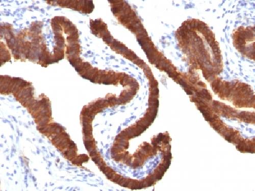 Immunohistochemistry (Formalin/PFA-fixed paraffin-embedded sections) - Anti-Cytokeratin 19 antibody [KRT19/799] - BSA and Azide free (AB212571), expandable thumbnail