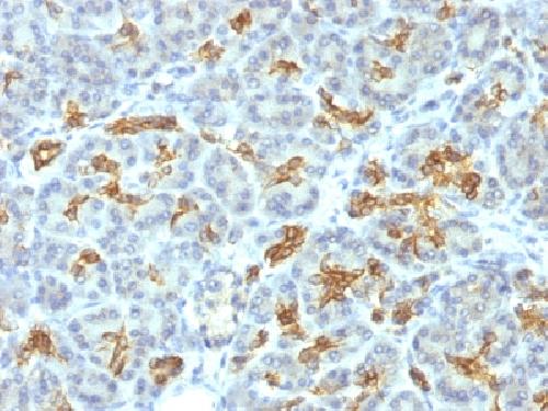 Immunohistochemistry (Formalin/PFA-fixed paraffin-embedded sections) - Anti-Cytokeratin 19 antibody [KRT19/799] - BSA and Azide free (ab212571), expandable thumbnail