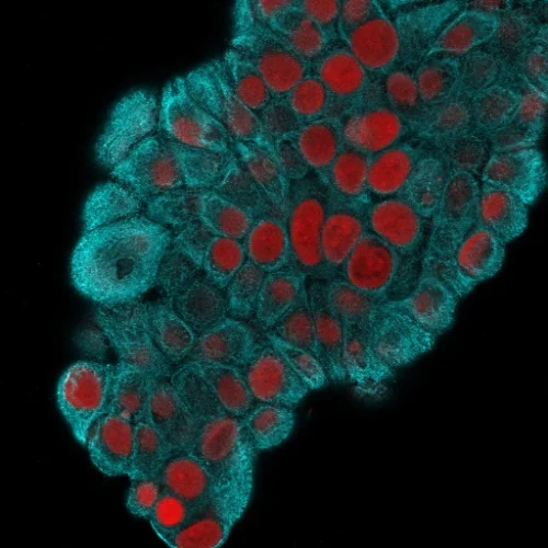 Immunocytochemistry - Anti-Cytokeratin 19 antibody [KRT19/800] (AB220193)