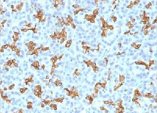 Immunohistochemistry (Formalin/PFA-fixed paraffin-embedded sections) - Anti-Cytokeratin 19 antibody [KRT19/800] (AB220193)