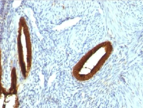 Immunohistochemistry (Formalin/PFA-fixed paraffin-embedded sections) - Anti-Cytokeratin 19 antibody [KRT19/800] (AB220193)