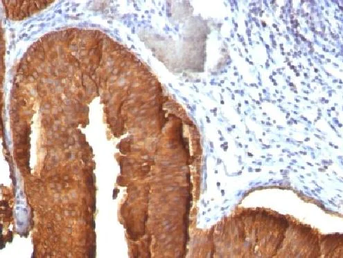 Immunohistochemistry (Formalin/PFA-fixed paraffin-embedded sections) - Anti-Cytokeratin 19 antibody [KRT19/800] (AB220193)