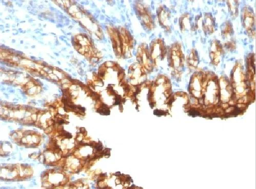 Immunohistochemistry (Formalin/PFA-fixed paraffin-embedded sections) - Anti-Cytokeratin 19 antibody [KRT19/800] (AB220193)