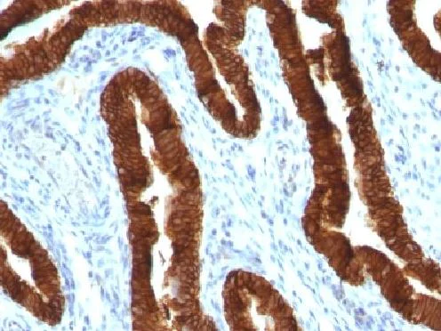 Immunohistochemistry (Formalin/PFA-fixed paraffin-embedded sections) - Anti-Cytokeratin 19 antibody [KRT19/800] (AB220193)
