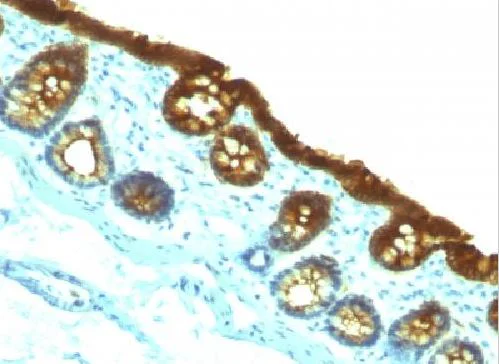 Immunohistochemistry (Formalin/PFA-fixed paraffin-embedded sections) - Anti-Cytokeratin 19 antibody [KRT19/800] (AB220193)