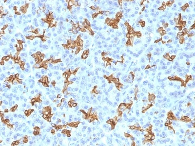 Immunohistochemistry (Formalin/PFA-fixed paraffin-embedded sections) - Anti-Cytokeratin 19 antibody [KRT19/800] - BSA and Azide free (AB212572)