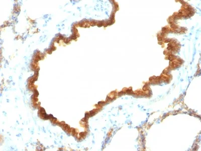 Immunohistochemistry (Formalin/PFA-fixed paraffin-embedded sections) - Anti-Cytokeratin 19 antibody [KRT19/800] - BSA and Azide free (AB212572)