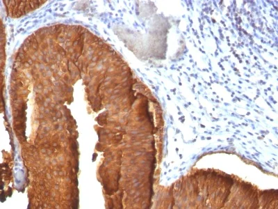 Immunohistochemistry (Formalin/PFA-fixed paraffin-embedded sections) - Anti-Cytokeratin 19 antibody [KRT19/800] - BSA and Azide free (AB212572)