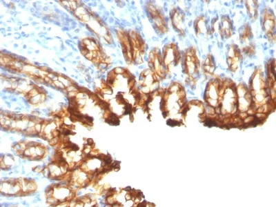 Immunohistochemistry (Formalin/PFA-fixed paraffin-embedded sections) - Anti-Cytokeratin 19 antibody [KRT19/800] - BSA and Azide free (AB212572)